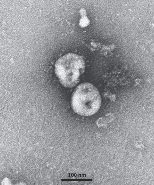 Незаразная зараза: почему коронавирус не превратится в глобальную угрозу (UPD.)